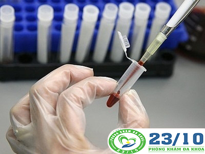 Phương pháp cân bằng miễn dịch trong hỗ trợ điều trị giang mai